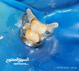  15 علاج اسنان مدينة الرياض