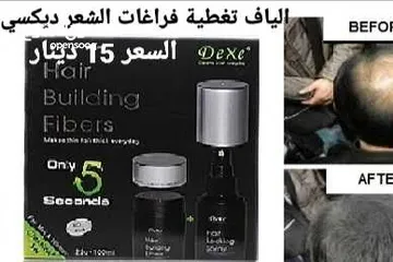  1 اخفاء فراغات صلع الراس الياف تغطية و تكثيف شعر الراس