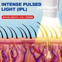  6 إزالة الشعر بالليزر 3 مصابيح و 700000 نبضة