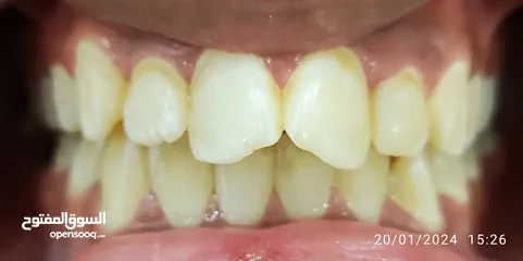 2 علاج اسنان مدينة الرياض