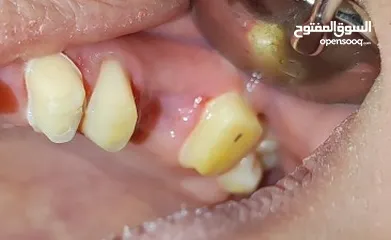  10 علاج اسنان مدينة الرياض