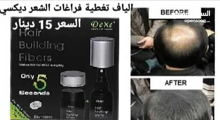  3 تخلص من الصلع اخفاء فراغات صلع الراس الياف تغطية و تكثيف شعر الراس Dexe Hair