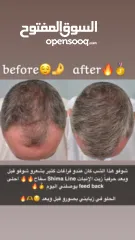  2 زيت الإِنبات ShimaLine