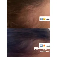  3 زيت الإِنبات ShimaLine