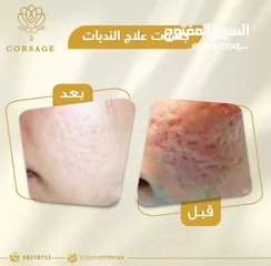  8 خدمات مركز تجميل