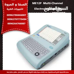  1 (ECG (ELECTROCARDIOGRAPH