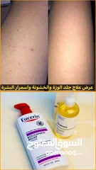  10 علاج جلد الأوزة