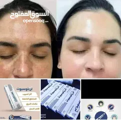  3 كريم تريتوسبوت الأصلي آمن على البشرة مرخص من وزارة الصحه الفلسطينيه
