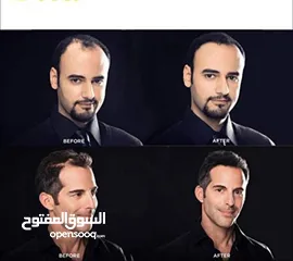  10 اخفاء صلع بودرة الياف تعبئه فراغات الشعر و تكثيفه و تغطية الصلع خلال 3 دقائق توبيك تكثيف شعر