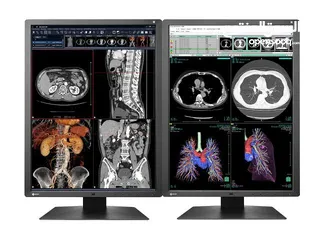  5 RX250 2MP 21.3" LCD Medical Display - RadiForce  EIZO‏