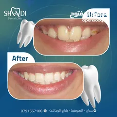  6 ادارة، تصميم ، فيديوهات ، كابشن ، اعلانات