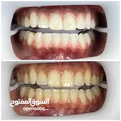  3 علاج اسنان مدينة الرياض