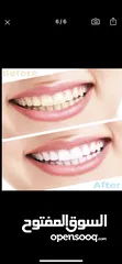  4 Teeth whitening