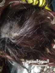  3 مقدمة شعر  طبيعي ميه بالميه