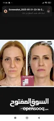  4 إبرة AestheFill الأصلية لتحفيز الكولاجين – بديل الفيلر والبوتوكس