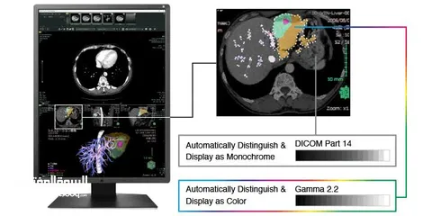  2 RX250 2MP 21.3" LCD Medical Display - RadiForce  EIZO‏