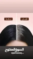  14 ‏Dexe Black Hair Shampoo   شامبو الشيب البريطاني الجديد للتخلص من الشيب (الشعر الأبيض )  إزال