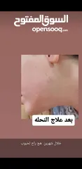  3 جميع المستحضرات من دكتورة خبيرة تجميل والله العضيم مجربات