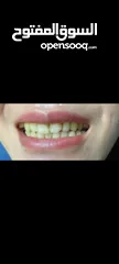  8 بودة تبييض الأسنان