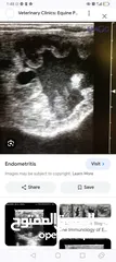  3 فحص الحمل بالسونار (الأشعة التلفزيونية)
