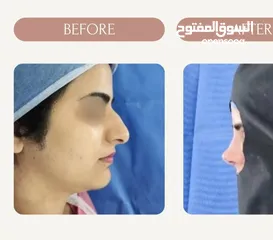  3 تجميل الأنف بأفضل الأسعار في بوشهر - الدكتور سلمان کوثري