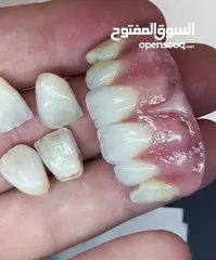  18 مختبرات لين للاسنان لصناعة كافة أنواع التركيبات الثابتة والمتحركة والتركيبات التقويمية وزراعة لاسنان