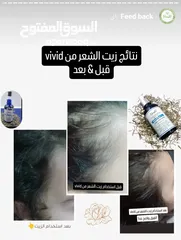  8 غسول بشرة يفتح لون البشرة من اول استعمال