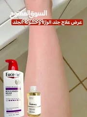 1 علاج جلد الأوزة