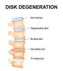  3 العلاج الطبيعي  Physiotherapy