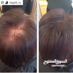  3 توبيك Toppik ، الحل الفوري للشعر الخفيف والصلع يقوم توبيك بملئ المناطق الفارغة بشكل فوري و يعوض