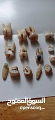  5 اسنان و نماذج اسنان ومواد طب اسنان (( مجموعة 3 ))