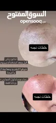  4 متوفر خلطه مع صابونه ايرانيه 