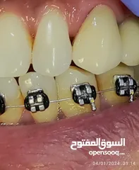  6 علاج اسنان مدينة الرياض