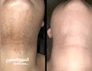  1 مقشر يهنيك من جميع تصبغات الجلدية