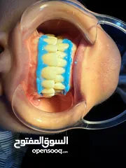  2 تعلن عيادات الكوثر و الكناري لطب وتجميل الاسنان   عروض