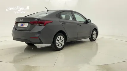  3 (HOME TEST DRIVE AND ZERO DOWN PAYMENT) HYUNDAI ACCENT