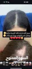  5 زيت رابونزل لتكثيف الشعر وإطالته