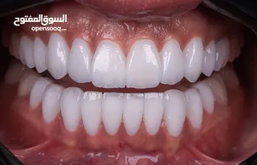  6 معالجة أسنان