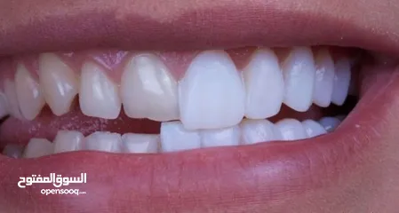  3 معالجة أسنان