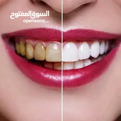  2 معجون اسنان الارجواني