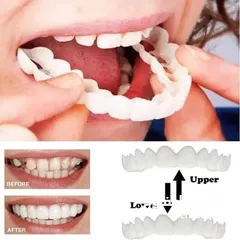  4 طقم اسنان تركيب