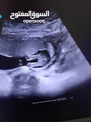  1 التراساوند بحال الوكاله