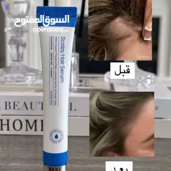  2 هل تحلمين بشعر أكثر كثافة و"بيبي هير" أطول وأقوى؟ نقدم لك