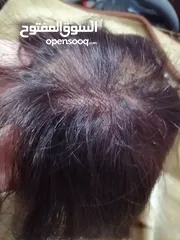  5 مقدمة شعر  طبيعي ميه بالميه
