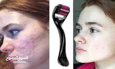  5 ديرما رولر derma roller ابر تيتانيوم للعناية بالبشرة و الشعر