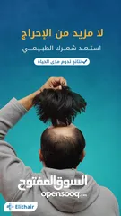  1 زراعة الشعر بأقل الأسعار فی ایران