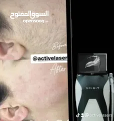  8 جهاز الليزر active sprite الاحدث جهاز ازاله الشعر بالليزر