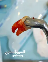  7 علاج اسنان مدينة الرياض