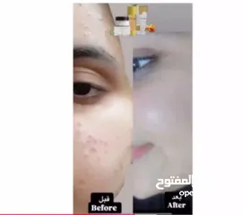  14 غسول منتج اورو الطبيعي للعناية بالبشرة والترطيب اليومي خالي من المواد الكيماوية