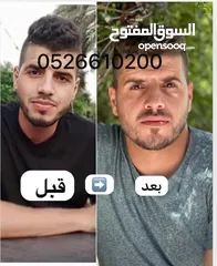  3 اعشاب طبيعيه لزيادة الوزن مضمون ومكفول